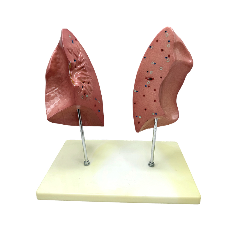 Pagtuturo ng biological model left and right lungs model human viscera lung anatomical model